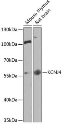 Western Blot: KIR2.3 AntibodyBSA Free [NBP3-03674]